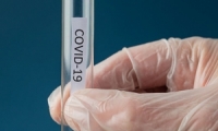 6861 إصابة جديدة بفيروس كورونا في في البلاد أمس الثلاثاء