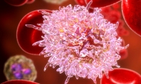 هل سرطان الدم مرض وراثي؟