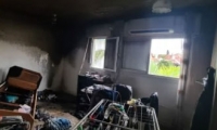اصابة حرجة جراء حريق بمنزل في كريات طبعون