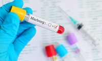 ماذا نعرف عن فيروس ماربورغ
