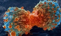 اربع مهن تحفز الأورام السرطانية