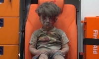 وفاة شقيق طفل حلب الذي أصابت صوره العالم بصدمة متأثرا بجروحه