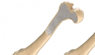 آلية بيولوجية جديدة تقوي العظام وقد تساعد على عكس الهشاشة