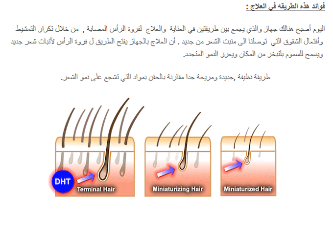 وداعا للصلع 